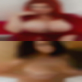 Bald women